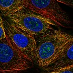 Atlas Antibodies Anti-NUDT14 Antibody