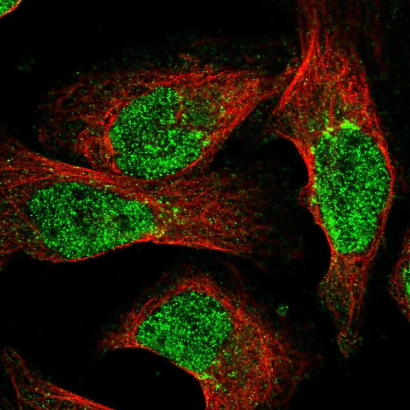 Atlas Antibodies Anti-NUDT18 Antibody