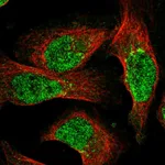 Atlas Antibodies Anti-NUDT18 Antibody