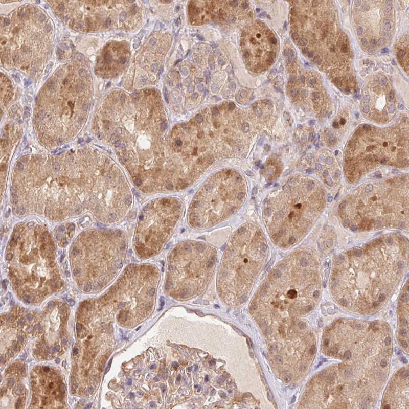 Atlas Antibodies Anti-NUDT16 Antibody