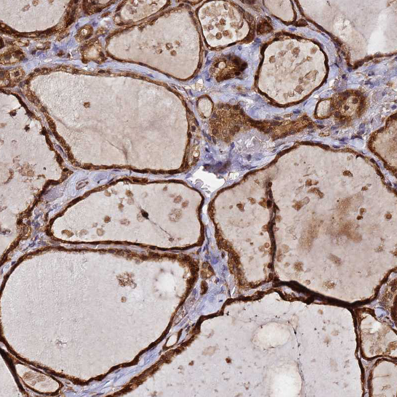 Atlas Antibodies Anti-NUDT14 Antibody