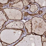Atlas Antibodies Anti-NUDT14 Antibody