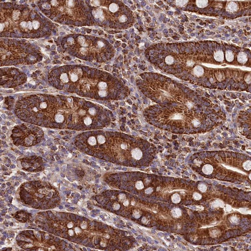 Atlas Antibodies Anti-NUDT15 Antibody