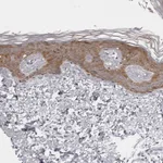 Atlas Antibodies Anti-NUDT18 Antibody