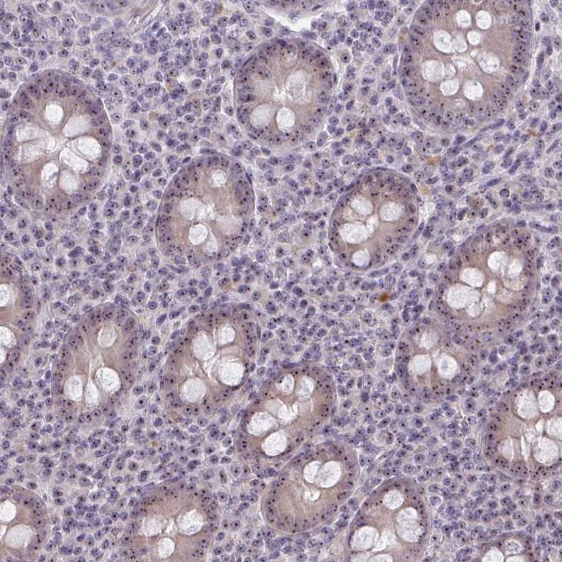 Atlas Antibodies Anti-NUDT16 Antibody