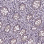 Atlas Antibodies Anti-NUDT16 Antibody