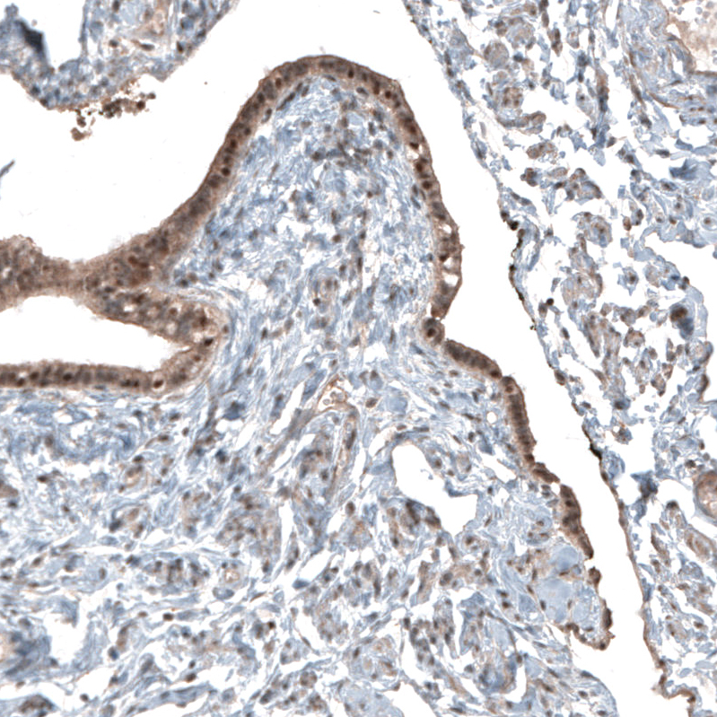 Atlas Antibodies Anti-NUDT16L1 Antibody