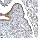 Atlas Antibodies Anti-NUDT16L1 Antibody