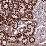 Atlas Antibodies Anti-NUDT16L1 Antibody