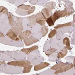 Atlas Antibodies Anti-NUDT3 Antibody
