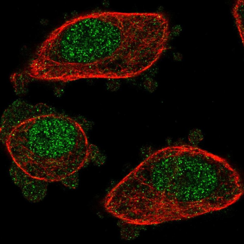 Atlas Antibodies Anti-NUDT2 Antibody
