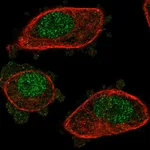 Atlas Antibodies Anti-NUDT2 Antibody