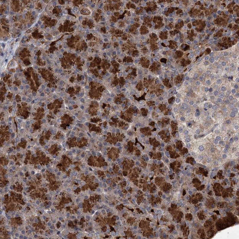 Atlas Antibodies Anti-NUDT22 Antibody