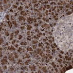 Atlas Antibodies Anti-NUDT22 Antibody