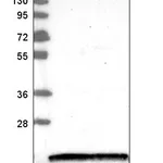 Atlas Antibodies Anti-NUDT2 Antibody