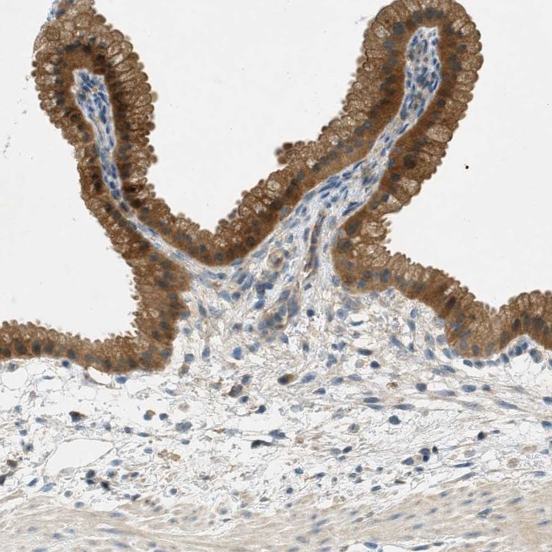 Atlas Antibodies Anti-NUDT4 Antibody