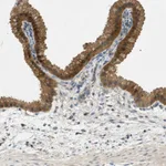 Atlas Antibodies Anti-NUDT4 Antibody
