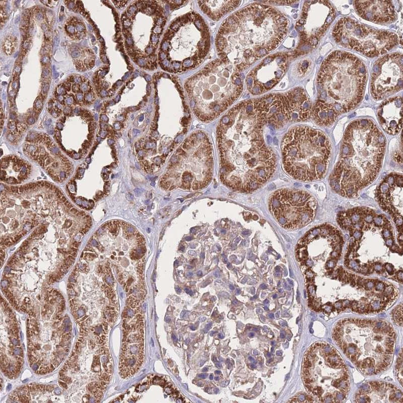 Atlas Antibodies Anti-NUDT21 Antibody