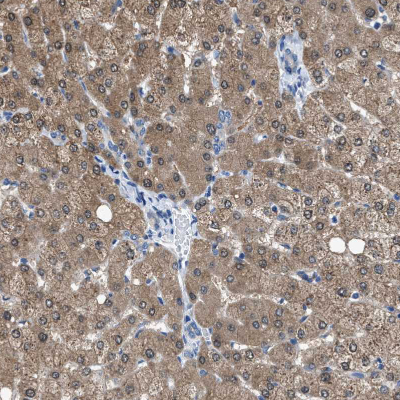 Atlas Antibodies Anti-NUDT5 Antibody