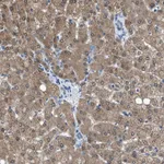 Atlas Antibodies Anti-NUDT5 Antibody