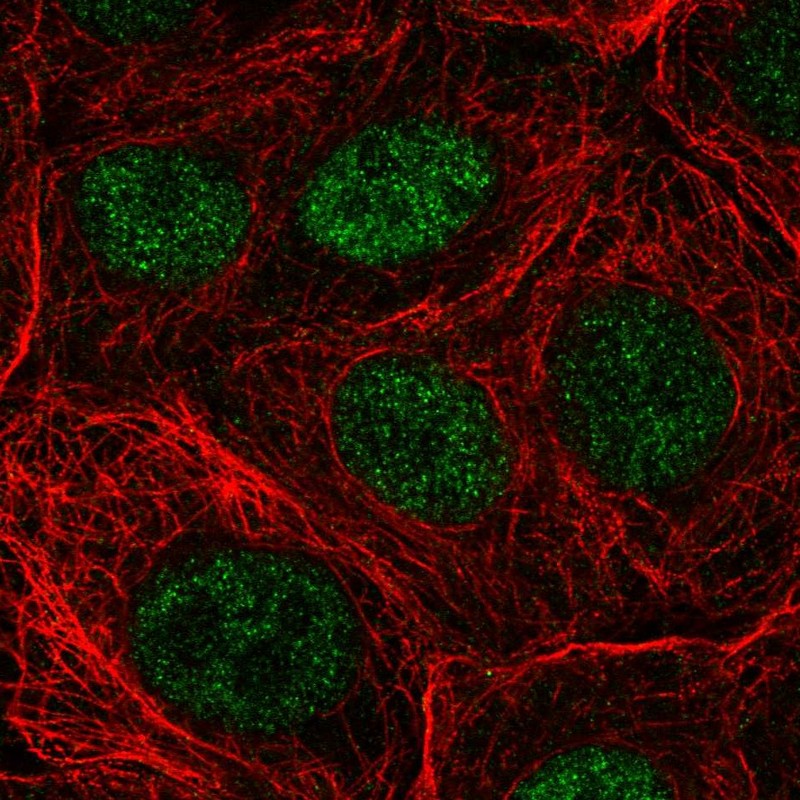 Atlas Antibodies Anti-NUDT22 Antibody