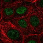 Atlas Antibodies Anti-NUDT22 Antibody