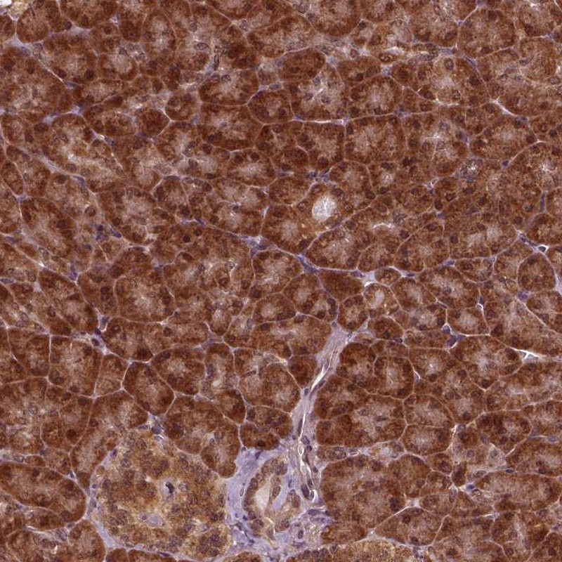 Atlas Antibodies Anti-NUDT9 Antibody