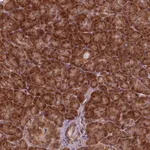 Atlas Antibodies Anti-NUDT9 Antibody