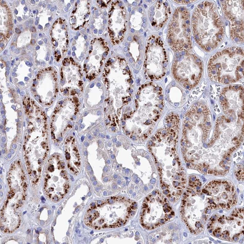Atlas Antibodies Anti-NUDT7 Antibody