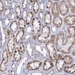 Atlas Antibodies Anti-NUDT7 Antibody