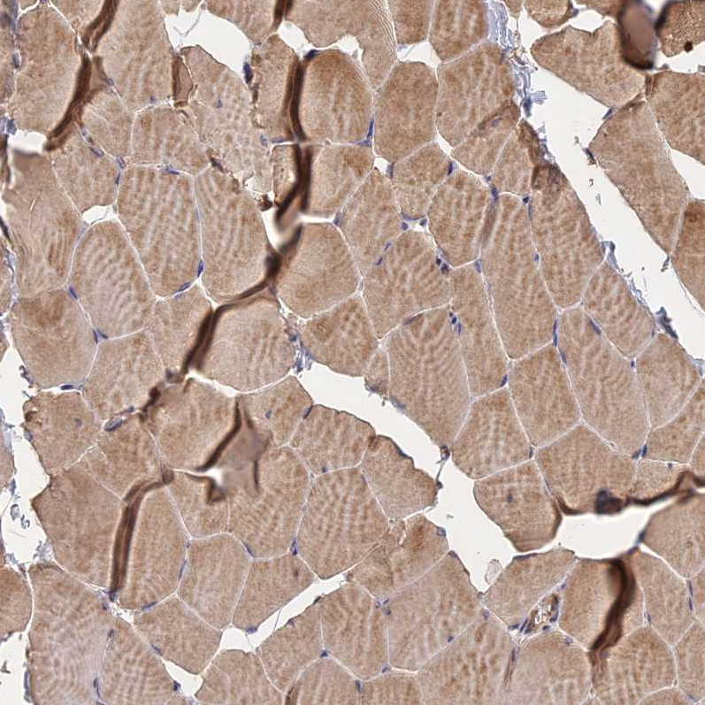 Atlas Antibodies Anti-NUDT8 Antibody