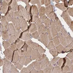 Atlas Antibodies Anti-NUDT8 Antibody
