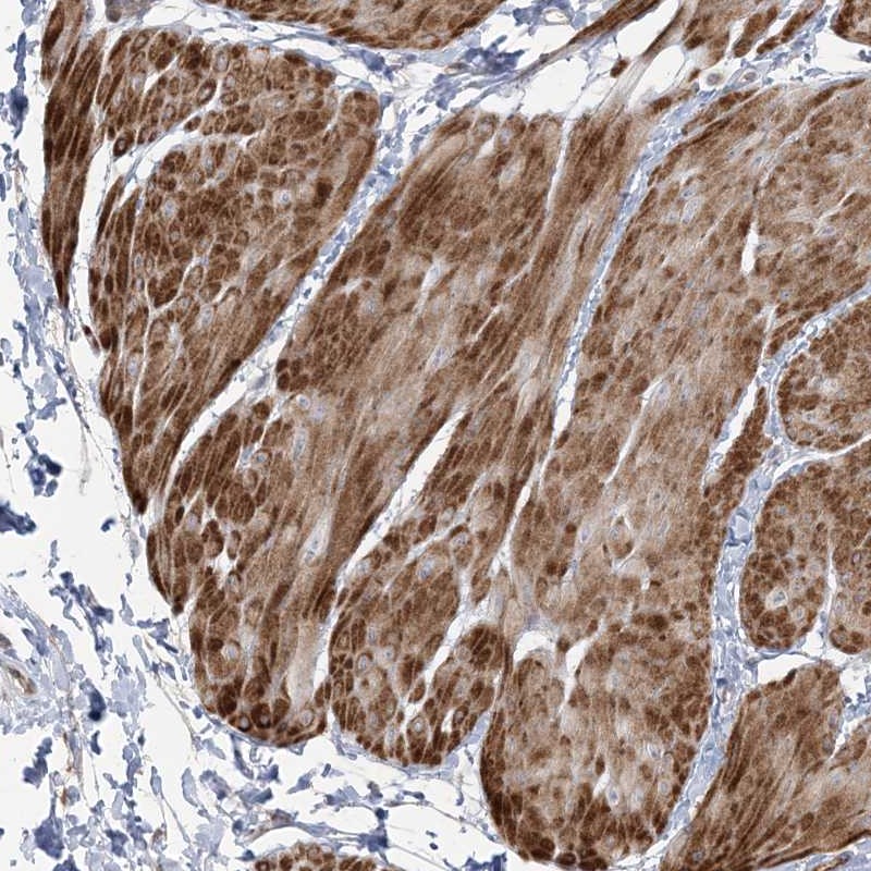 Atlas Antibodies Anti-NUDT9 Antibody