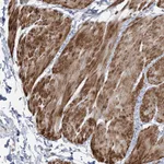 Atlas Antibodies Anti-NUDT9 Antibody