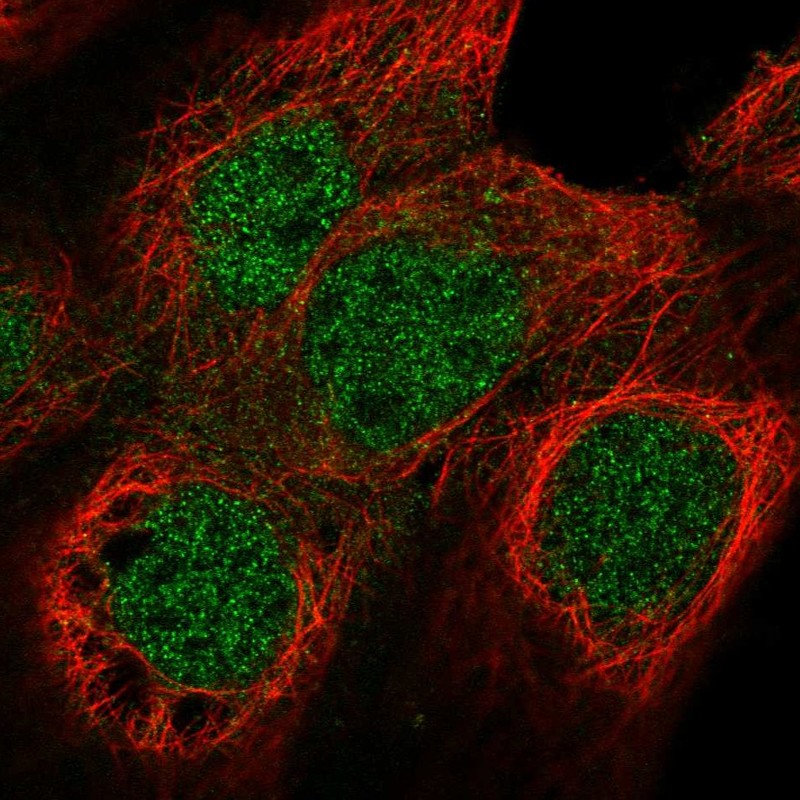 Atlas Antibodies Anti-NUF2 Antibody