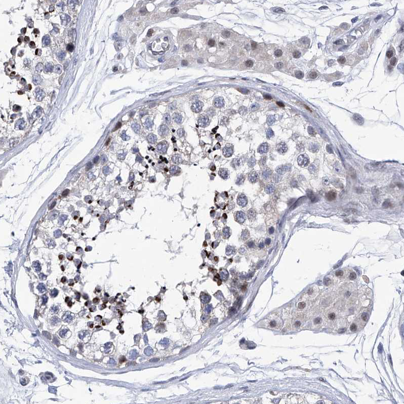 Atlas Antibodies Anti-NUFIP1 Antibody