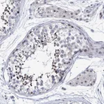 Atlas Antibodies Anti-NUFIP1 Antibody