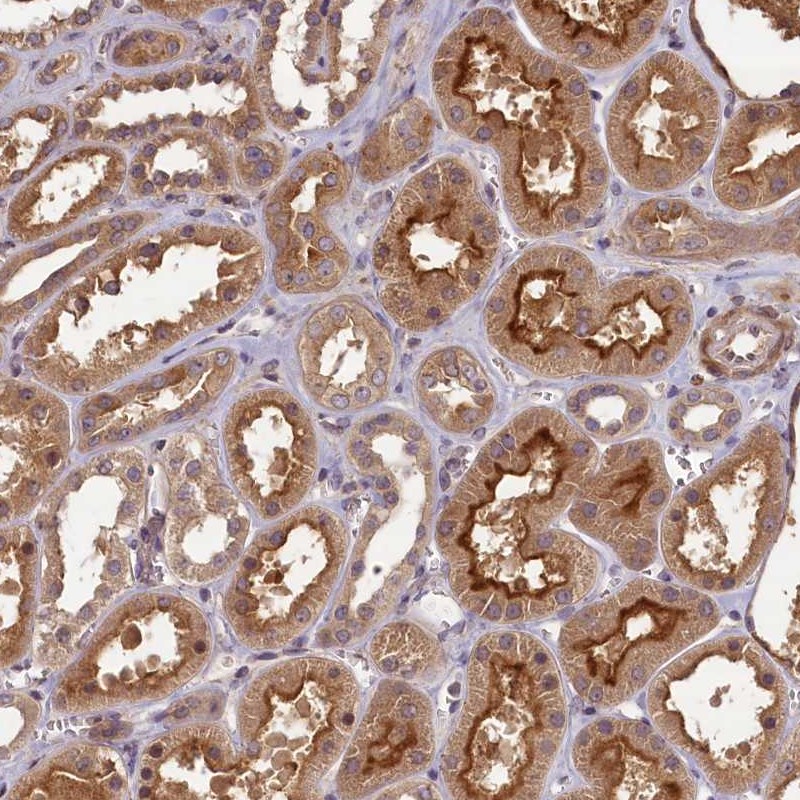 Atlas Antibodies Anti-NUDT6 Antibody