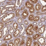 Atlas Antibodies Anti-NUDT6 Antibody
