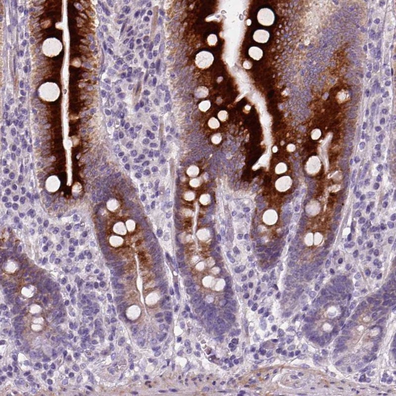 Atlas Antibodies Anti-NUDT6 Antibody