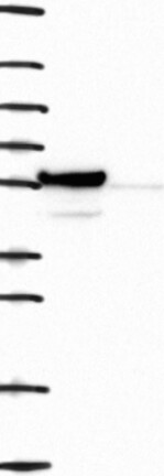Atlas Antibodies Anti-NUF2 Antibody