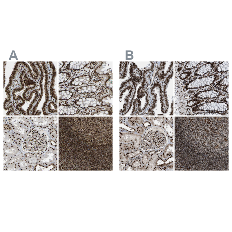 Atlas Antibodies Anti-NUMA1 Antibody
