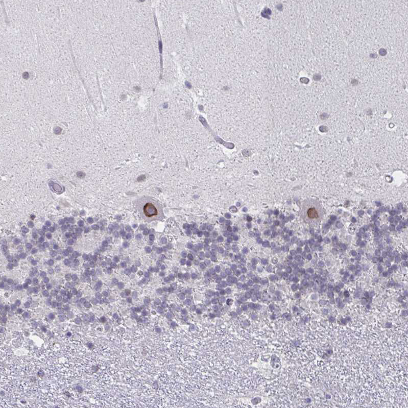 Atlas Antibodies Anti-NUP133 Antibody