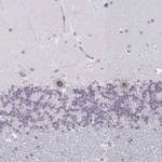 Atlas Antibodies Anti-NUP133 Antibody