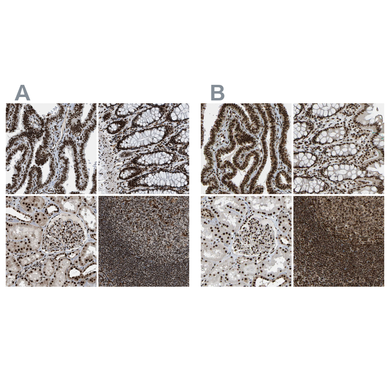 Atlas Antibodies Anti-NUMA1 Antibody