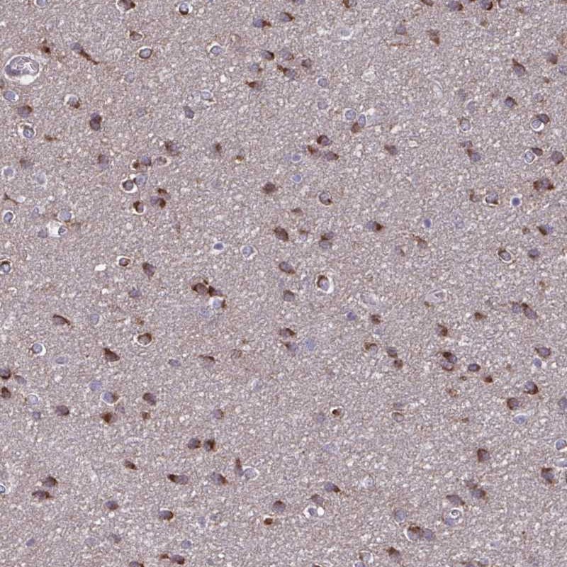 Atlas Antibodies Anti-NUMBL Antibody
