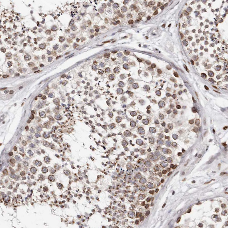 Atlas Antibodies Anti-NUP153 Antibody