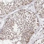 Atlas Antibodies Anti-NUP153 Antibody