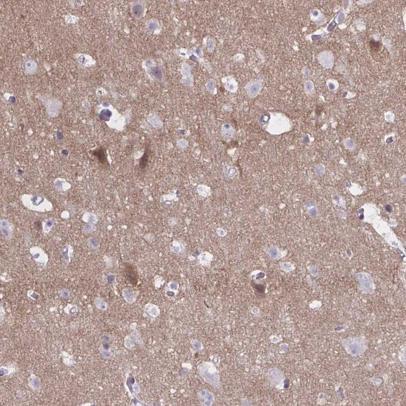 Atlas Antibodies Anti-NUMBL Antibody
