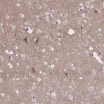 Atlas Antibodies Anti-NUMBL Antibody